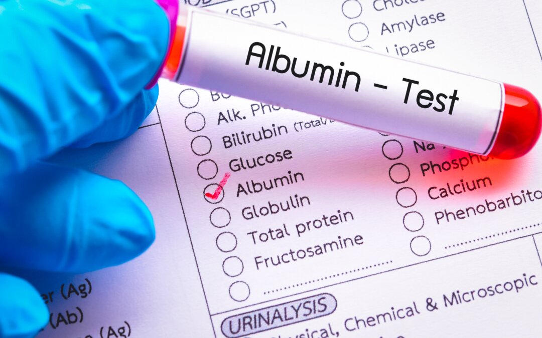 Albumin: Understanding the Protein, Your Kidneys, and Symptoms | Docty Clinics